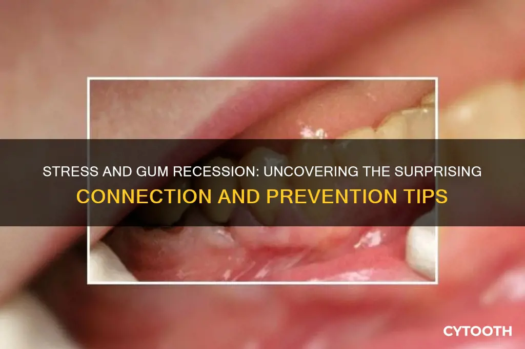 does stress cause gum recession