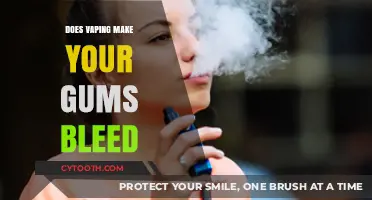 Vaping and Gum Health: Does It Cause Bleeding Gums?
