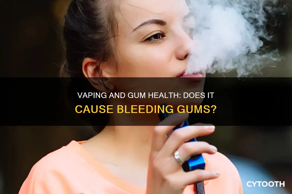 does vaping make your gums bleed
