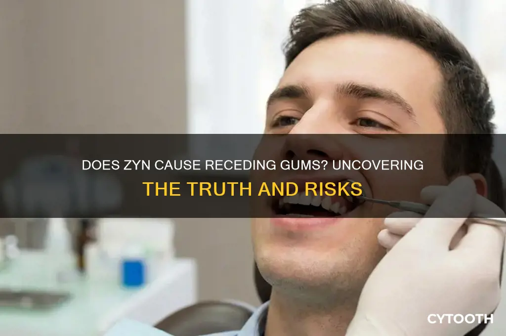 does zyn cause receding gums
