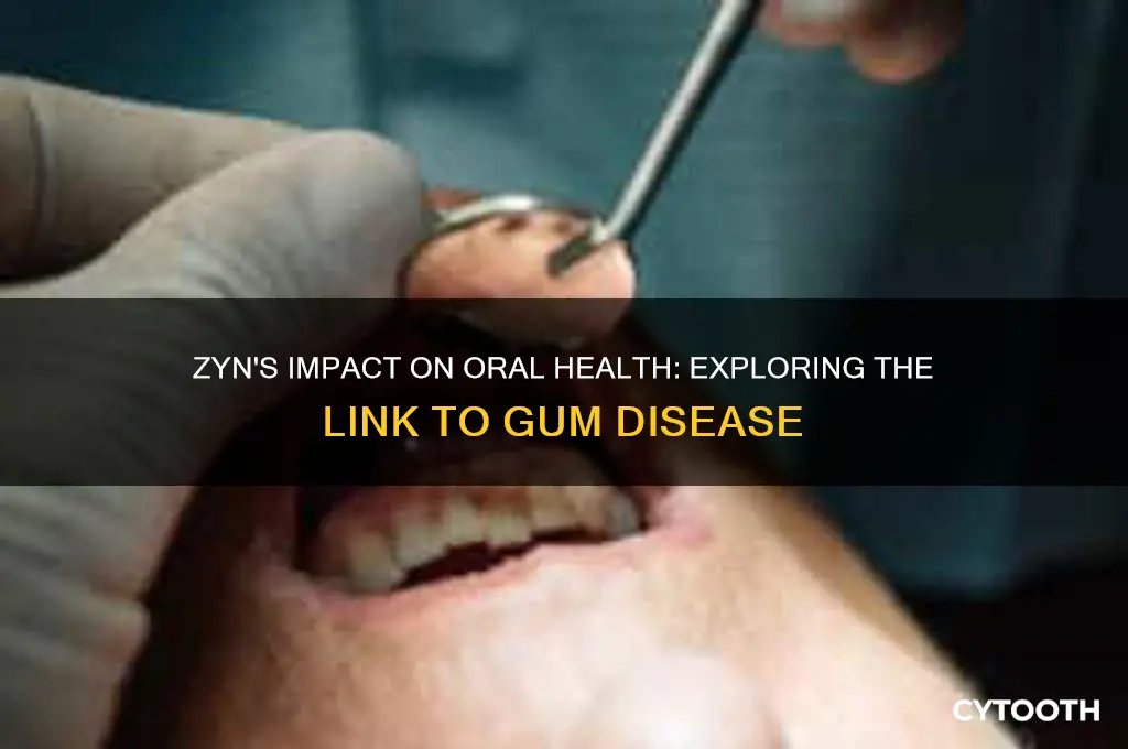 does zyns cause gum disease