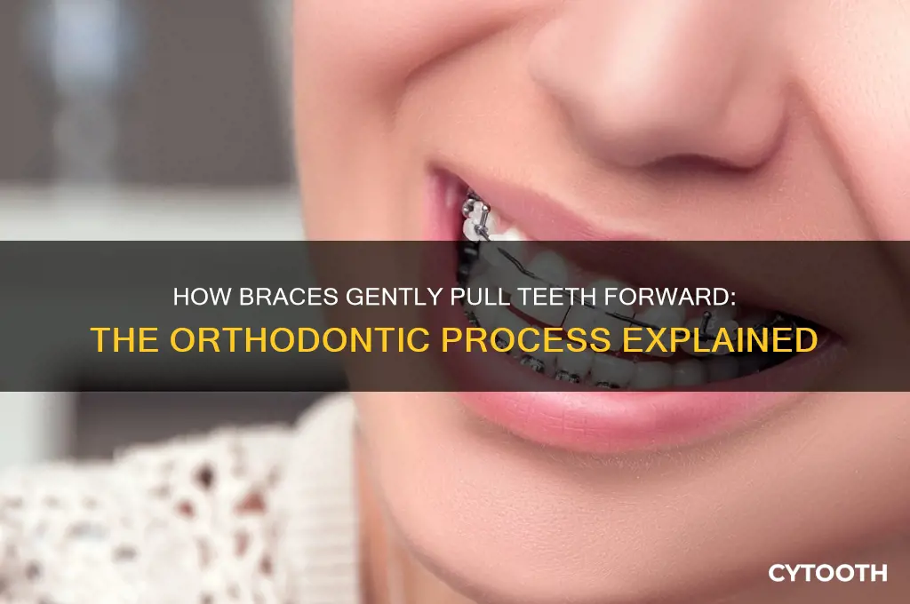 how do braces pullva tooth forward
