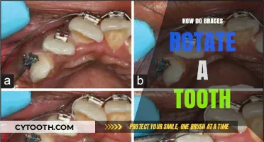 How Braces Rotate Teeth: Understanding Orthodontic Mechanics and Movement
