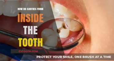 Understanding Cavity Formation: How Decay Eats Away at Your Teeth