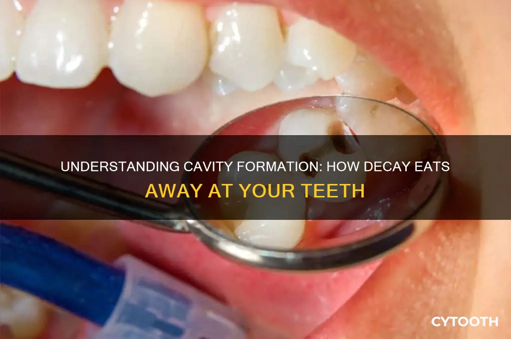 how do cavities form inside the tooth