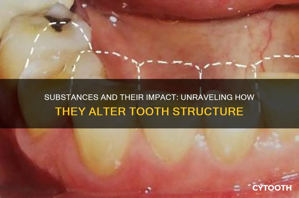 how do certain substances affect the tooths structure