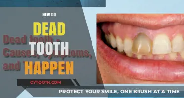 Understanding Dead Teeth: Causes, Symptoms, and Treatment Options Explained
