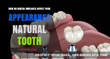 Dental Implants vs. Natural Teeth: Enhancing Your Smile and Appearance
