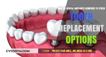 Dental Implants vs. Bridges, Dentures: Which Tooth Replacement Option is Best?
