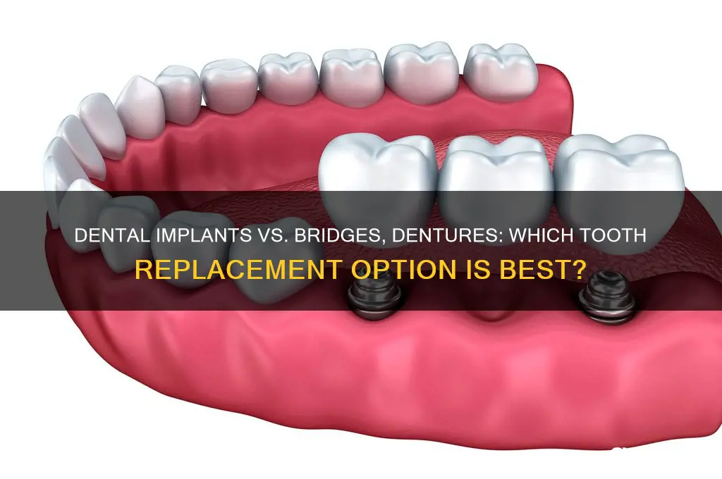 how do dental implants compare to other tooth replacement options