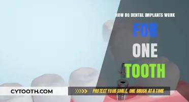 Understanding Dental Implants: A Single Tooth Replacement Solution Explained