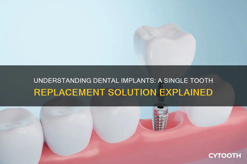 how do dental implants work for one tooth