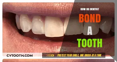 Understanding the Tooth Bonding Process: A Dentist's Step-by-Step Guide