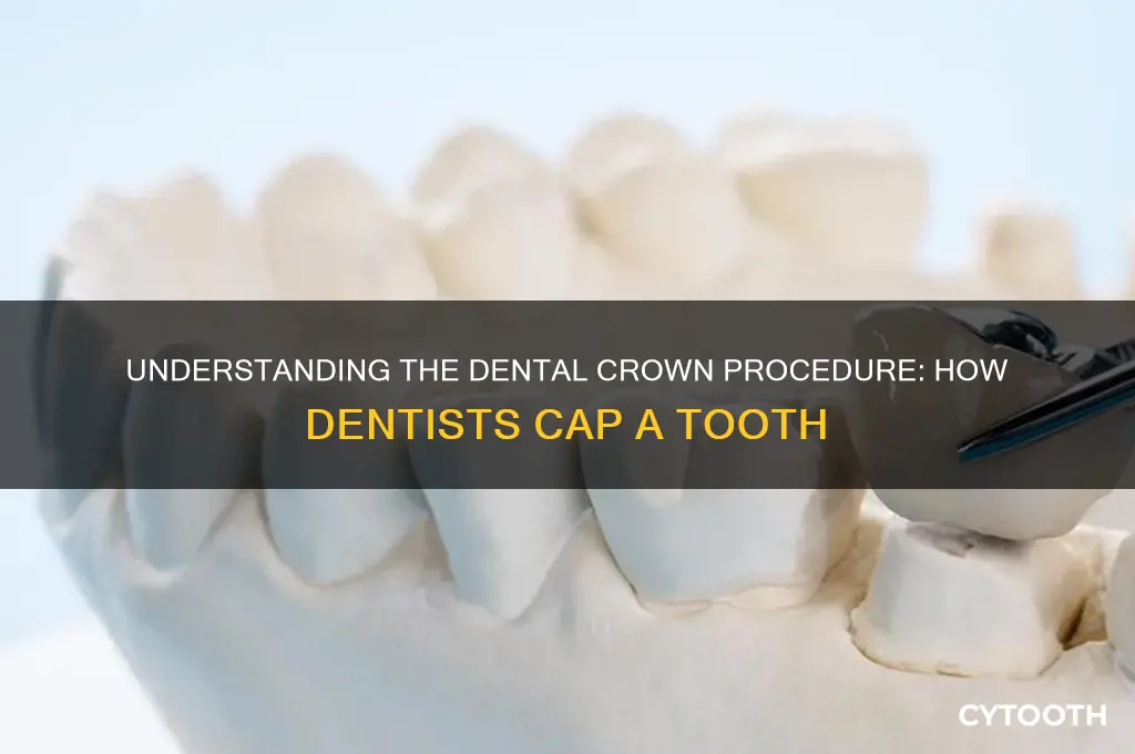 how do dentist cap a tooth