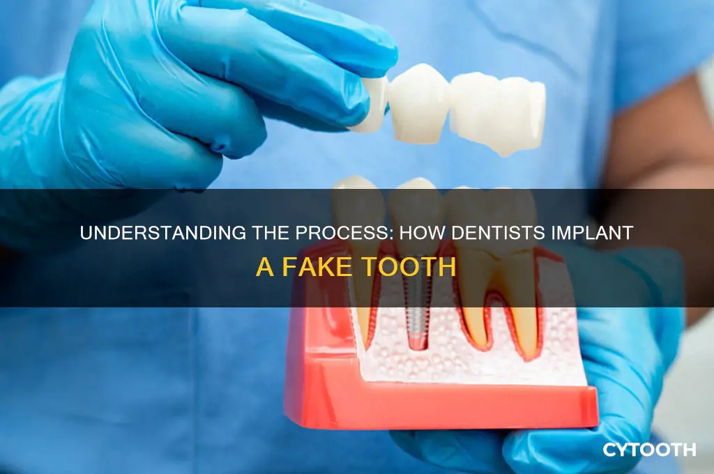 how do dentist put in a fake tooth