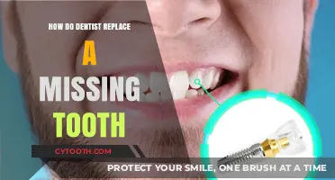 Replacing Missing Teeth: Dental Solutions for a Complete Smile