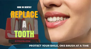 Tooth Replacement Options: How Dentists Restore Your Smile Naturally