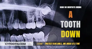 How Dentists Safely Bring a Tooth Down: The Eruption Process Explained