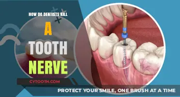 How Dentists Perform Root Canals to Remove Infected Tooth Nerves