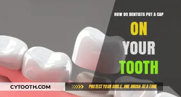 Understanding Dental Crowns: How Dentists Cap Your Tooth for Strength and Beauty