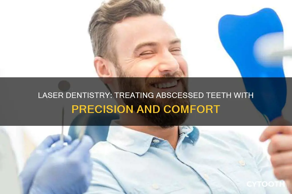 how do dentists use lasers for abcessed tooth