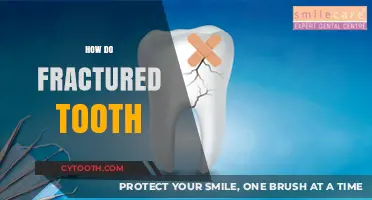 Understanding Fractured Teeth: Causes, Symptoms, and Treatment Options