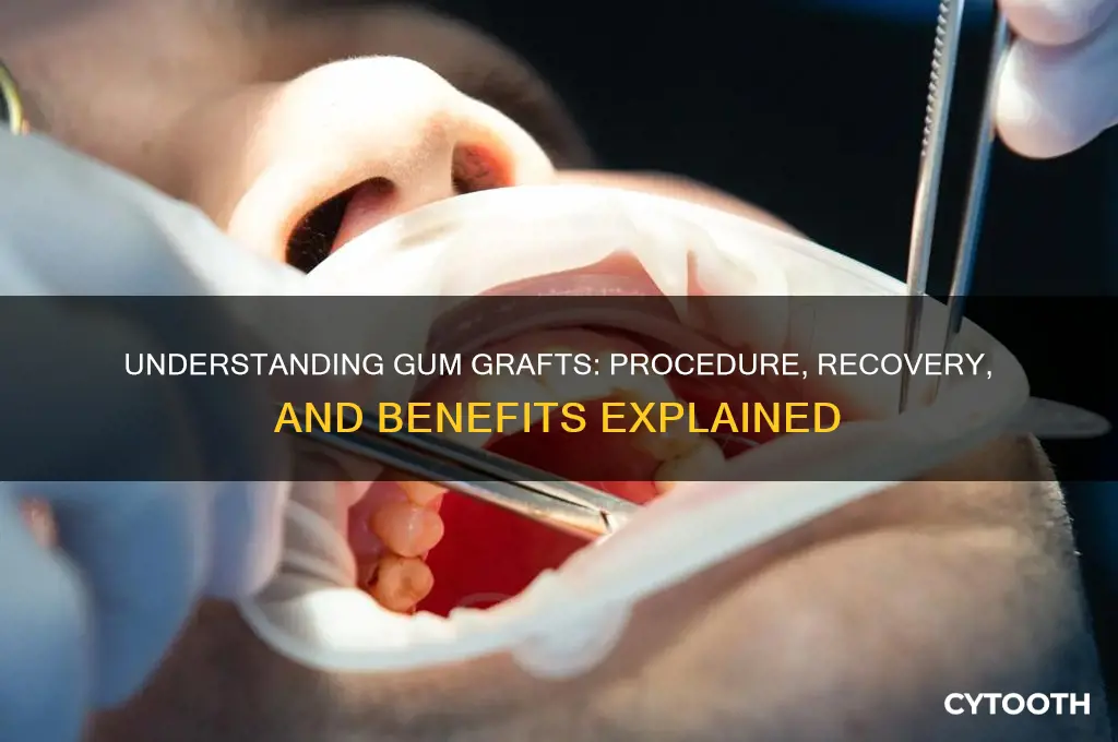 how do gum grafts work