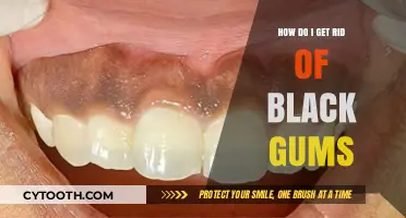 Effective Ways to Treat and Prevent Black Gums Naturally