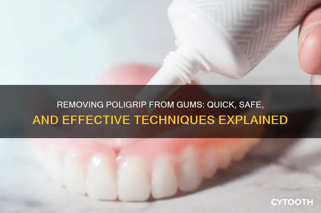how do you get poligrip off your gums