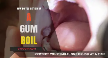 Effective Ways to Treat and Eliminate Painful Gum Boils Fast
