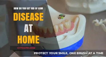Effective Home Remedies to Treat and Prevent Gum Disease Naturally