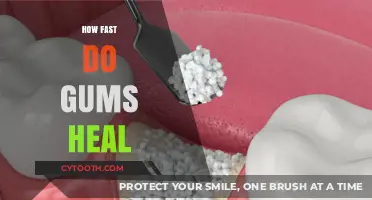 Speedy Gum Recovery: Understanding the Healing Process and Timeline