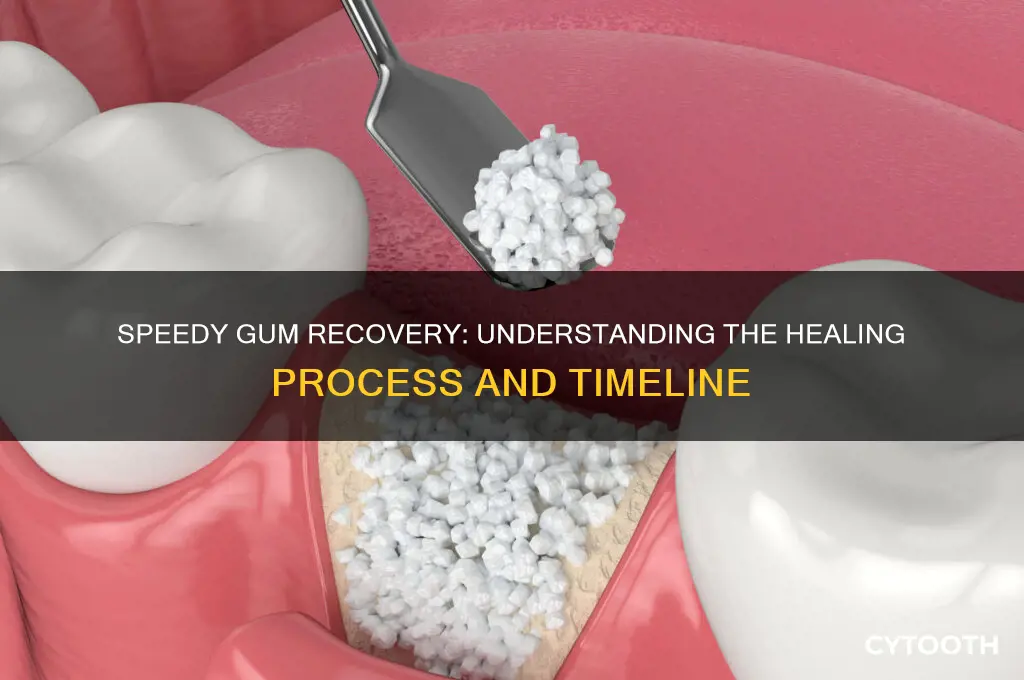 how fast do gums heal