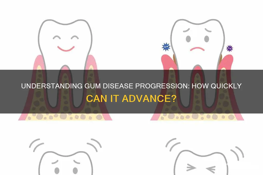 how fast does gum disease progress