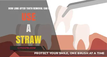 Post-Tooth Extraction: When Can You Safely Use a Straw Again?