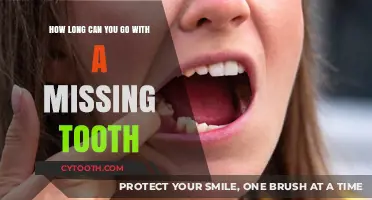 Living with a Missing Tooth: How Long Can You Wait?