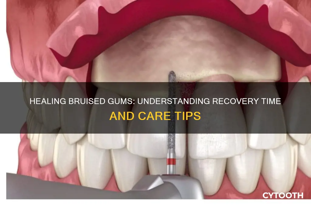 how long do bruised gums take to heal