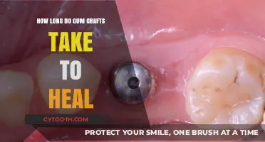 Gum Graft Healing Time: What to Expect After Surgery