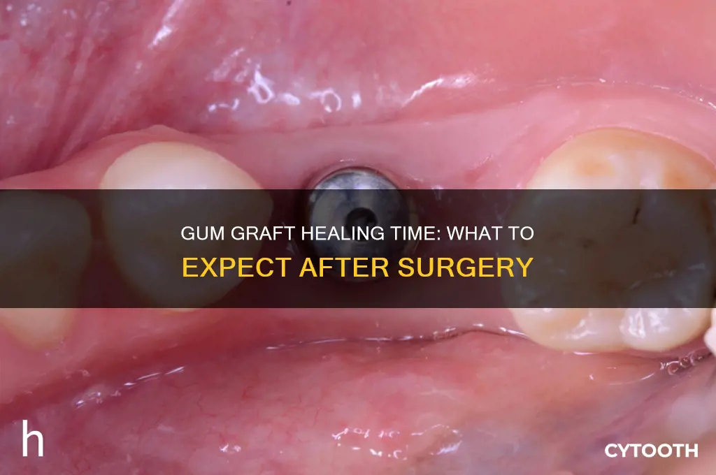 how long do gum grafts take to heal