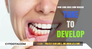 Understanding the Timeline: How Long Does Gum Disease Develop?