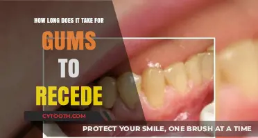 Understanding Gum Recession: Timeline and Factors Affecting Healing Process