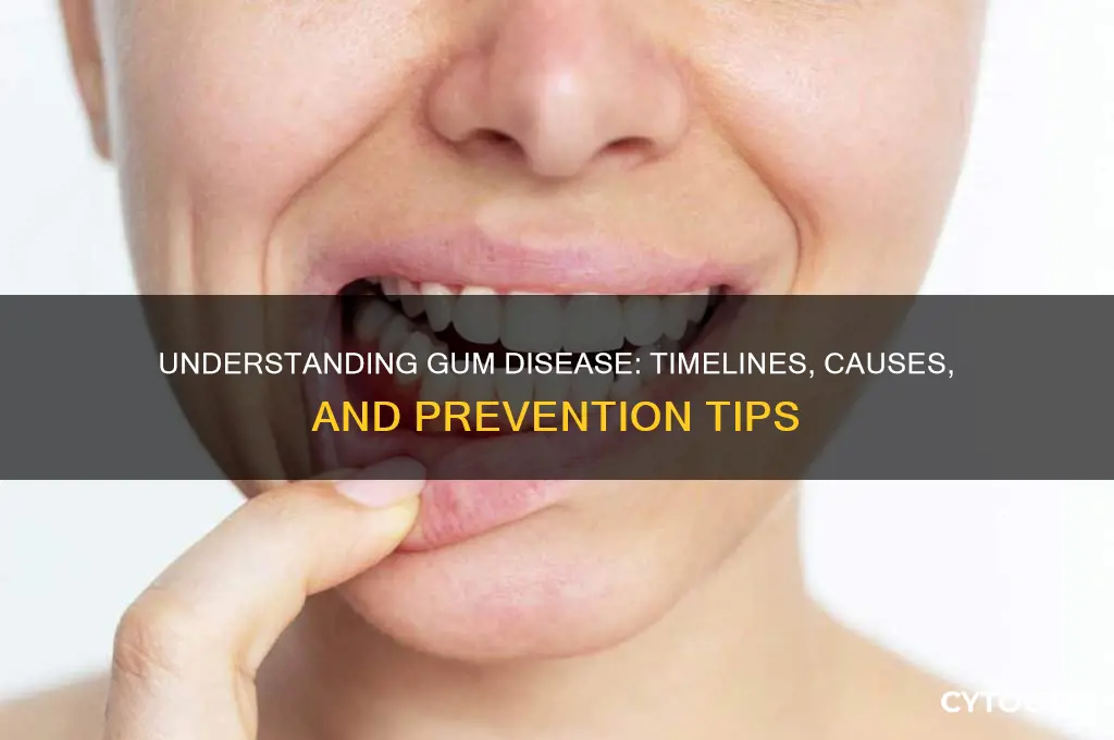 how long does it take to get gum disease
