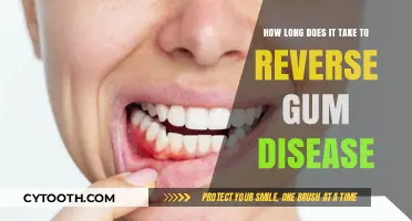 Reversing Gum Disease: Understanding the Timeline for Healthy Gums