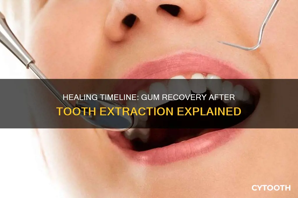 how long does the gum heal after tooth extraction