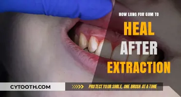Healing Timeline: How Long Does Gum Recovery Take Post-Tooth Extraction?