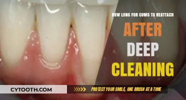 Gums Reattachment Timeline: What to Expect After Deep Cleaning