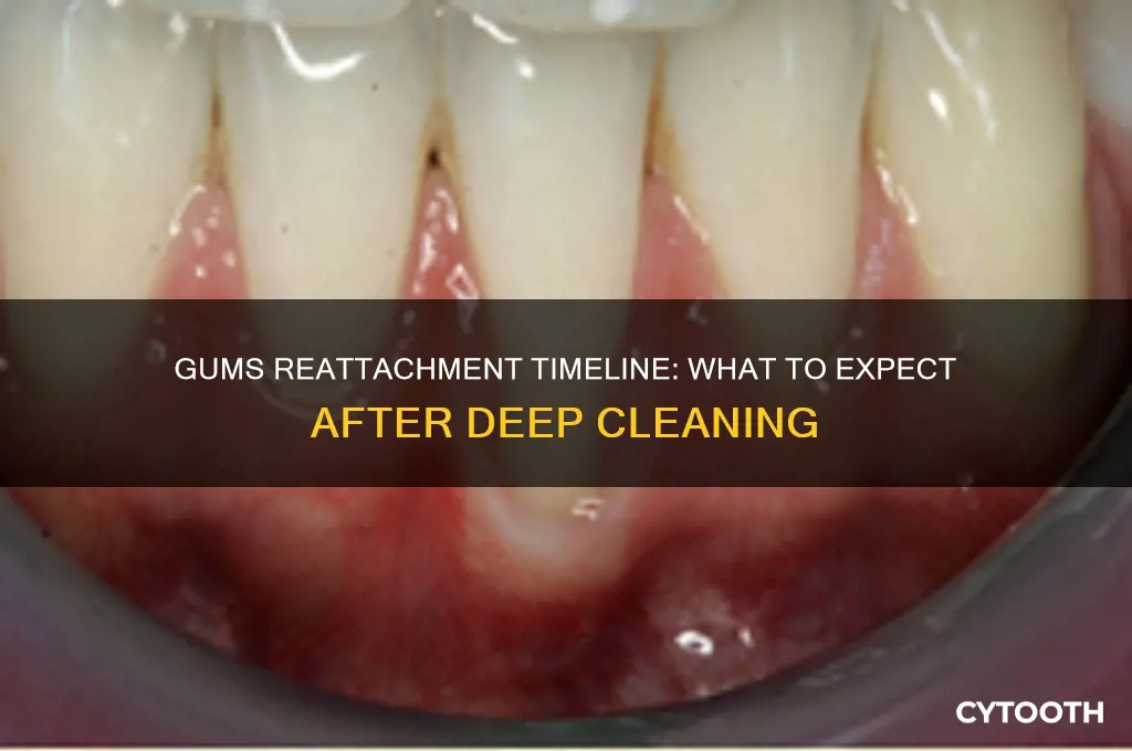 how long for gums to reattach after deep cleaning