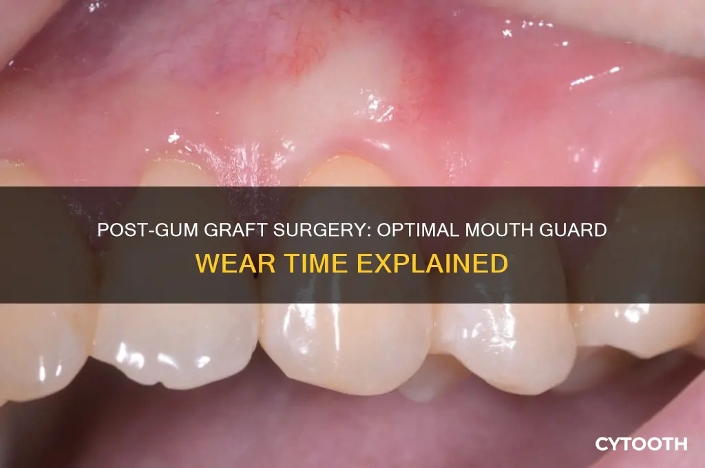 how long to wear mouth guard after gum graft surgery