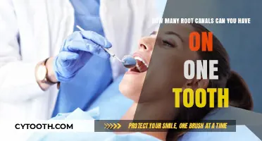 Understanding Multiple Root Canals on a Single Tooth: Is It Possible?