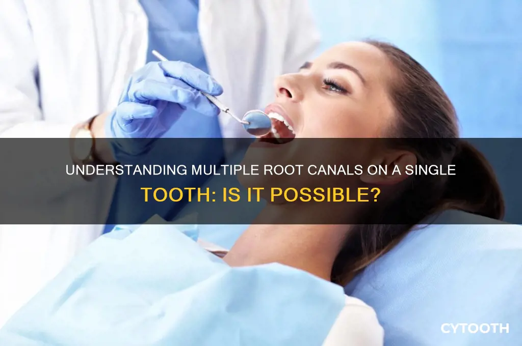 how many root canals can you have on one tooth